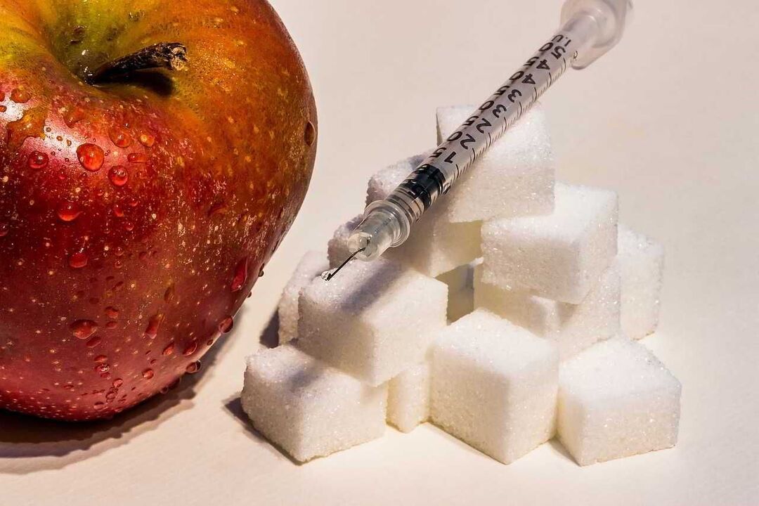 Diabetes Mellito entwickelt sich vor dem Hintergrund des Mangels an Insulin und einer Zunahme der Glukose im Blut